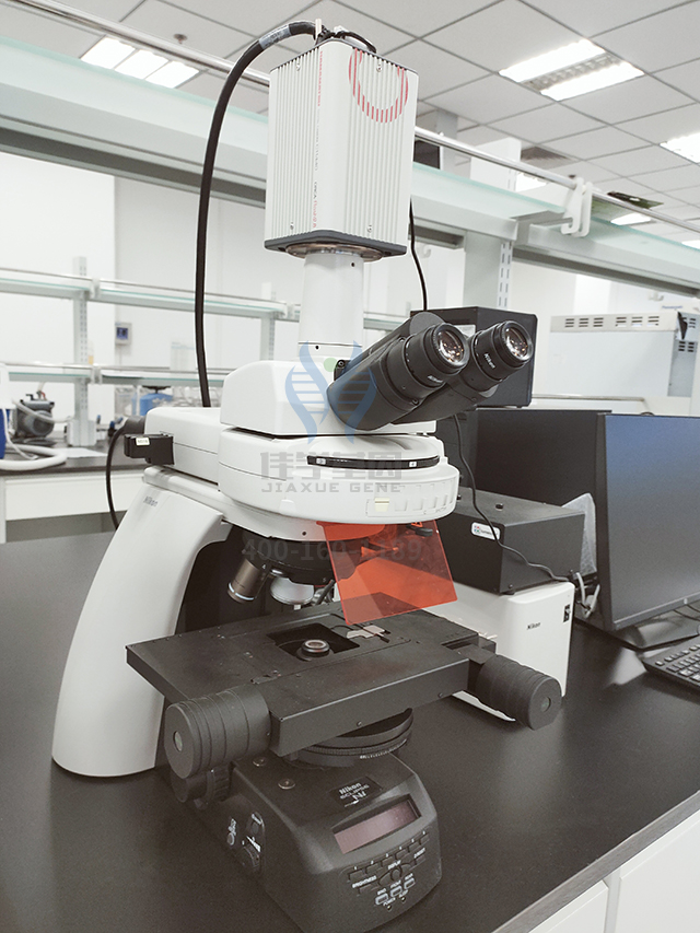 梅艳芳二哥梅德明患喉癌去世 梅家四兄妹三位因癌病逝 梅艳芳二哥梅德明患喉癌去世 梅家四兄妹三位因癌病逝