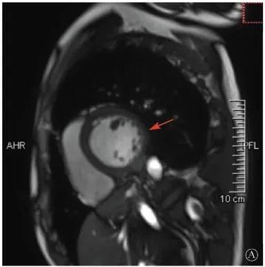 【惊人】基因检测解决心血管疾病诊断和治疗疑难 【惊人】基因检测解决心血管疾病诊断和治疗疑难