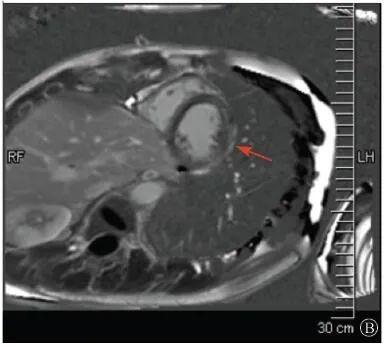 【惊人】基因检测解决心血管疾病诊断和治疗疑难