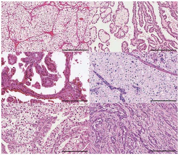 【佳学基因检测】肾脏癌靶向药物基因检测(Kidney Cancer) 【佳学基因检测】肾脏癌靶向药物基因检测(Kidney Cancer)