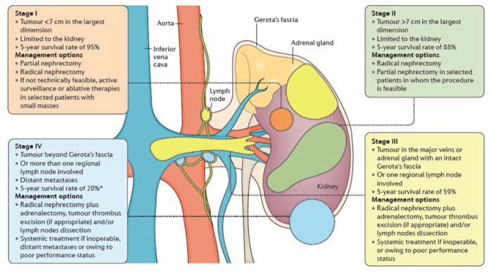 【佳学基因检测】肾脏癌靶向药物基因检测(Kidney Cancer) 【佳学基因检测】肾脏癌靶向药物基因检测(Kidney Cancer)