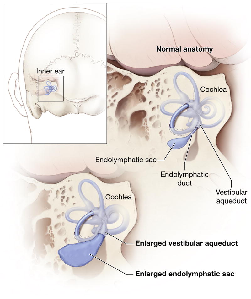 【佳学基因检测】前庭窗异常基因检测 Abnormality of the vestibular window 【佳学基因检测】前庭窗异常基因检测 Abnormality of the vestibular window