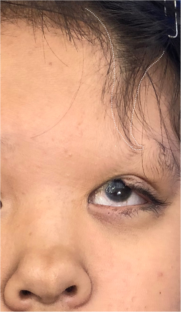 【佳学基因检测】鼻尖裂成两半基因解码、基因检测怎么预约解读? 【佳学基因检测】鼻尖裂成两半基因解码、基因检测怎么预约解读?