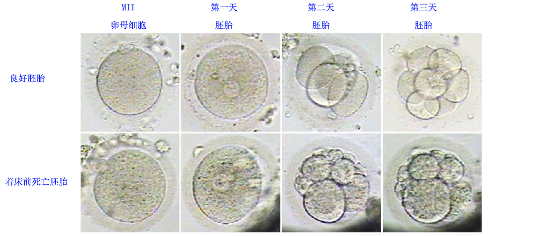 【佳学基因检测】TEX28P2疾病风险评估的人工智能分析进展到什么地步？