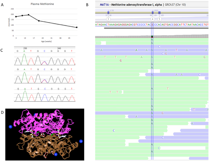 【佳学基因检测】高蛋氨酸血症基因检测案例 【佳学基因检测】高蛋氨酸血症基因检测案例