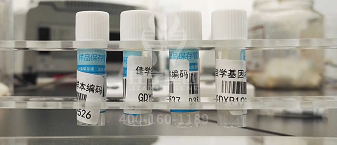 【佳学基因检测】肚子里的胎儿有三个月了,基因检测DAG1突变,该怎么办? 【佳学基因检测】肚子里的胎儿有三个月了,基因检测DAG1突变,该怎么办?