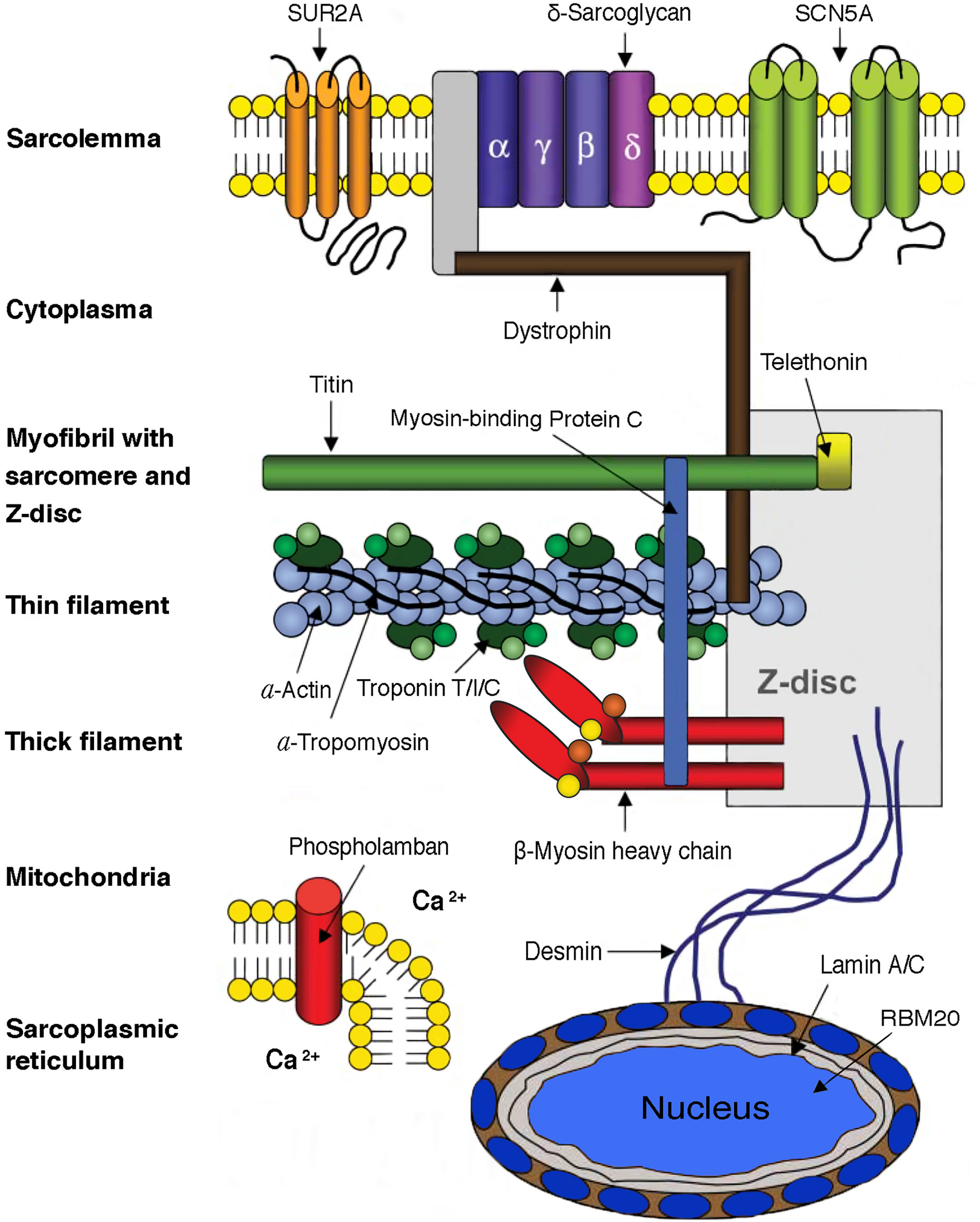 【佳学基因检测】一图展示全面性扩张型心肌病基因检测的位点及遗传方式 【佳学基因检测】一图展示全面性扩张型心肌病基因检测的位点及遗传方式