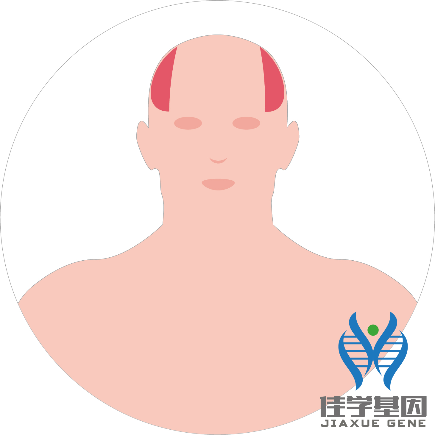 【佳学基因检测】男性脱发(Androgenetic alopecia)基因解码、基因检测 【佳学基因检测】男性脱发(Androgenetic alopecia)基因解码、基因检测