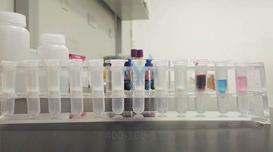 【佳学基因-基因检测】时而狂躁不安,时而抑郁低落,要小心是双向情感障碍 【佳学基因-基因检测】时而狂躁不安,时而抑郁低落,要小心是双向情感障碍