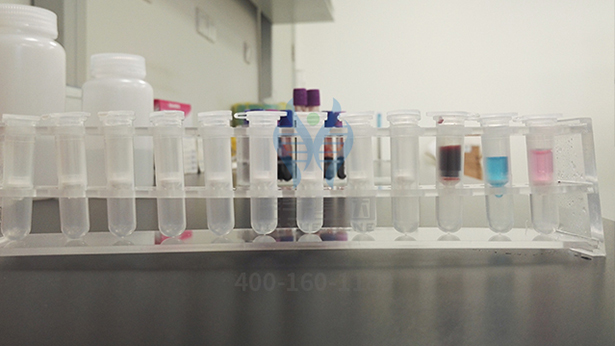 【佳学基因-基因检测】这个家庭15口人均是六指!基因解码找原因 【佳学基因-基因检测】这个家庭15口人均是六指!基因解码找原因